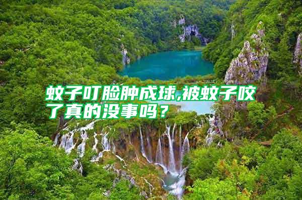 蚊子叮臉腫成球,被蚊子咬了真的沒事嗎？