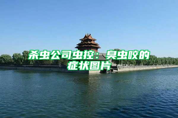 殺蟲公司蟲控：臭蟲咬的癥狀圖片