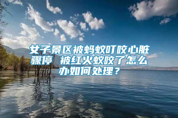 女子景區(qū)被螞蟻叮咬心臟驟停 被紅火蟻咬了怎么辦如何處理？